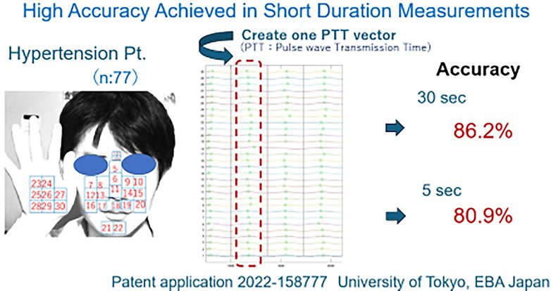 High accuracy in short duration measurements for hypertension patients; accuracy rates: 86.2% (30 sec), 80.9% (5 sec).