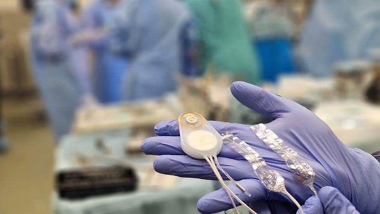 A hand in a surgical glove holds CorTec's Brain Interchange System device in a medical setting. A hand in a surgical glove holds CorTec's Brain Interchange System device in a medical setting.