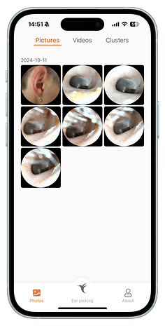 Bebird app interface showing images of ear cleaning procedures.