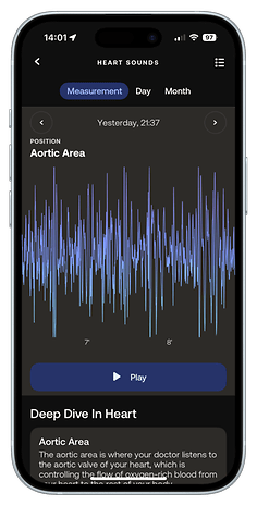 Screen displaying heart sounds measurement with a graph and details about the aortic area.