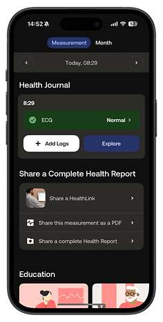 Health Journal screen from Withings Body Scan app showing ECG results and sharing options.