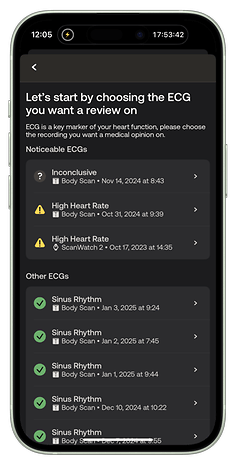 Mobilappskärm som visar EKG-alternativ, inklusive inkonklusiva och hög hjärtfrekvensvarningar.