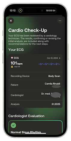 EKG-rapport från Withings som visar en hjärtfrekvens på 101 slag/min, märkt som hög HR.