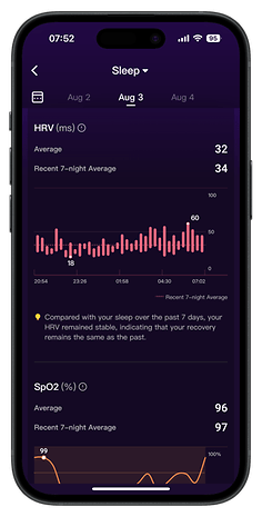 Screenshots of the RingConn Gen 2 Smart Ring app companion user interface.