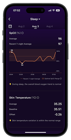 Screenshots of the RingConn Gen 2 Smart Ring app companion user interface.