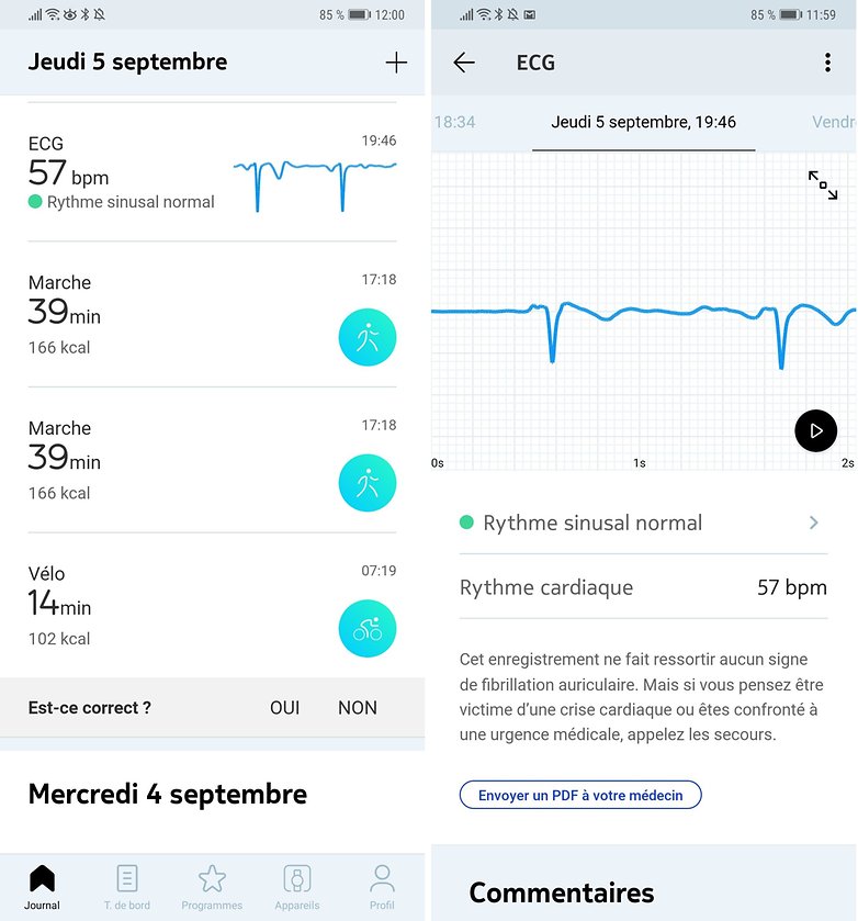 androidpit withings app ecg
