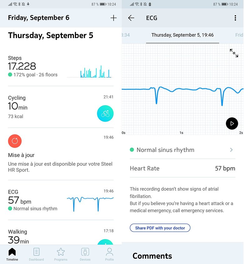 androidpit withings app ecg