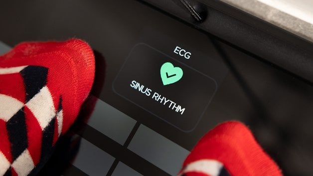 Feet in colorful socks on a device displaying 'ECG' and 'SINUS RHYTHM' with a green check mark.