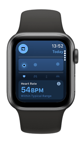 An Apple Watch SE 3 shows a heart rate of 54 BPM, which falls within the normal range.