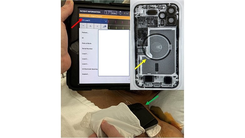 iPhone 12 MagSafe Medtronic implantierter Defibrillator