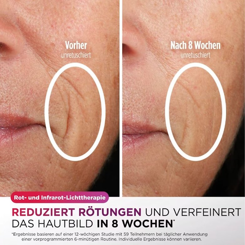 Verbessertes Hautbild Verbessertes Hautbild